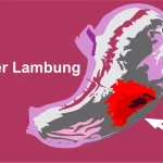 Kanker Lambung, Gejala, Faktor Penyebab, dan Prosedur Pengobatannya