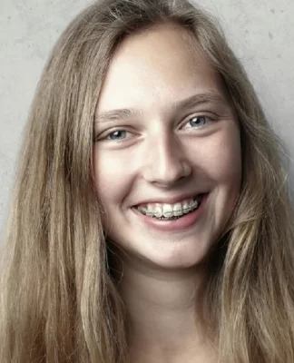Merapikan Gigi Dengan Kawat Gigi (braces)